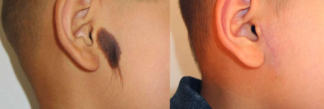 Ę��������ë�������ȥ���