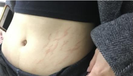 ȥ����y���֏�(f��)Ч����Ŀ�