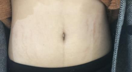 ȥ����y���֏�(f��)Ч����Ŀ�