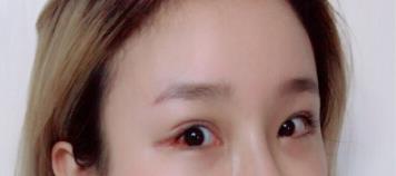 �p��Ƥ�ޏ�(f��)��������ҵ��p��Ƥ