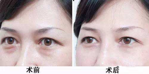 ���۴����g(sh��)ʧ��֮���Ў׷N�ޏ�(f��)����