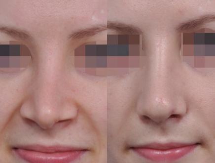 �Ў׷N�ǿ׿sС�g(sh��)�з�ʽ��