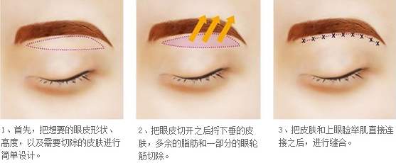 ��ü�g(sh��)�g(sh��)���Ч�����