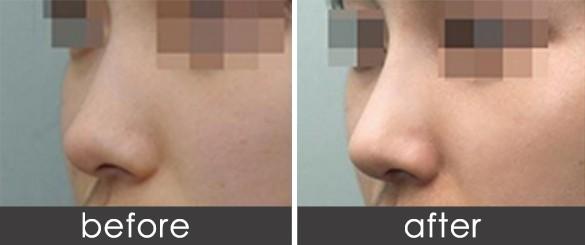 ��С�����L���g(sh��)����ô�M�е�