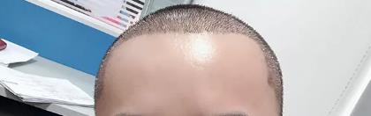 ֲ�l(f��)6����Ч�����w������һ���