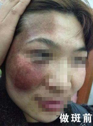 �ί�̫������зNϲ�O�����ĸ��X