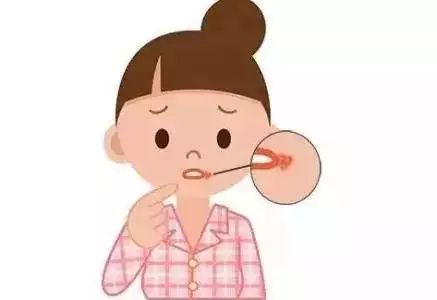 长沙希美口角成形术后多久恢复