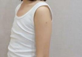 ���w֬��¡���g����Ҳ�Ǵ�����һö