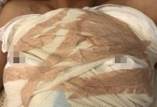 ���w֬��¡���g����Ҳ�Ǵ�����һö