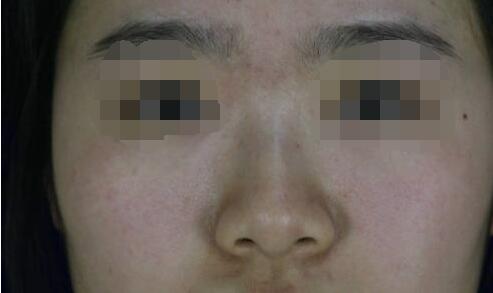 ¡���g����^ͦ�N�A�����؄e���