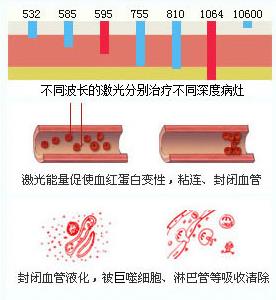 �e�ٱ�̥ӛ֧���������