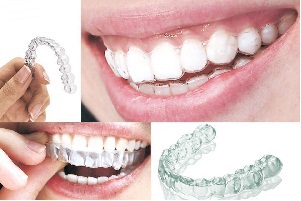 ��e���S�����Ͼ����X���׵ăr��