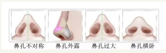 �C������Ǵ�s����(g��)�º󣬱��ӕ�(hu��)�֏�(f��)����