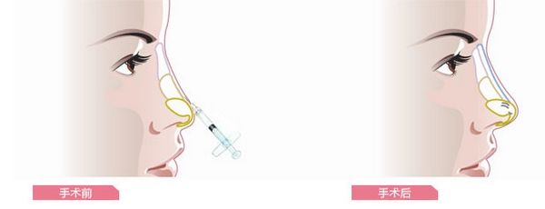 ������¡����ʲô��(y��u)������������¡�Ǳ�����׃���᣿