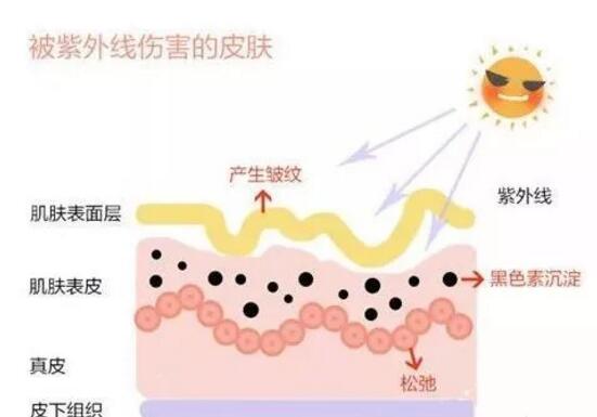 皮肤光老化