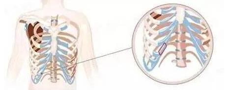 ¡�����g(sh��)�������ܛ��߀��Ӳ������