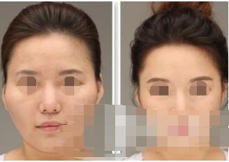 �E�����ε�Ч����ô��?