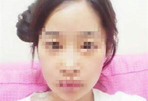 ��(f��)�ϲʹ����w��׌Ƥ�w�⻬��z�������Ѷ��۲���֣�