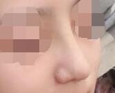 һ���ώ���¡��ʧ�������