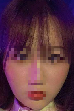 ���Ę���^�沿��֬���g����׃����Ę���F�ڱ��˷Q��Ů��