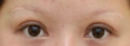 üë�Nֲ��Q��������üë�^�ٵĆ��}