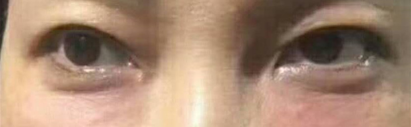 �L�ڰ�ҹ�L�۴���׌�ҟo����ɓp�����������۴����g�ͽ�Q