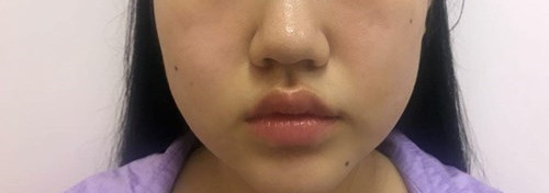 �沿��֬��Ŀ���׌�˓��о���СĘ��