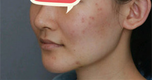 ���z�|�°������F(xi��n)�ҵ�СĘ��