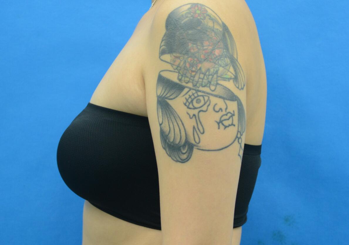 �ֱ���(g��)�ѝh���������꼤����֬���ֱ�Ҳ����С�B����