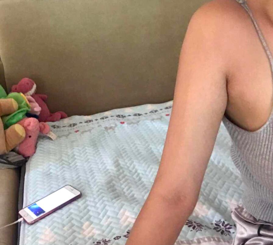 �ֱ���(g��)�ѝh���������꼤����֬���ֱ�Ҳ����С�B����