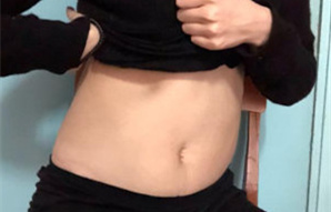 腹部的脂肪終于離我遠(yuǎn)去,我能自信地穿上漂亮的裙子了