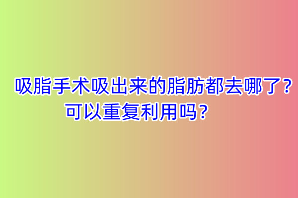 ��֬���g(sh��)��������֬����ȥ�����������؏�(f��)���Æ᣿