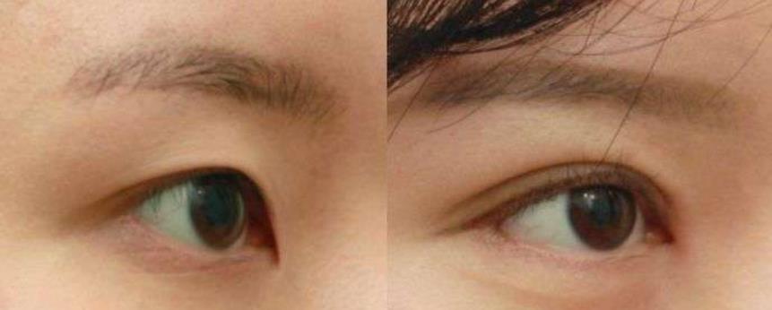 ���p��Ƥ��߀��ȫ����ȡ�Q�ڱ��˵��۲��l���͠�B(t��i)