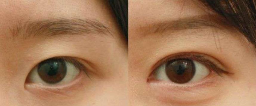 ���p��Ƥ��߀��ȫ�У�ȡ�Q�ڱ��˵��۲��l���͠�B(t��i)