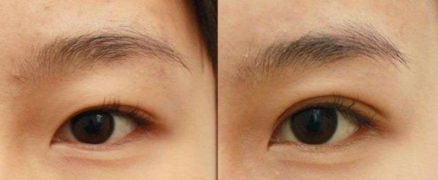 ���p��Ƥ��߀��ȫ����ȡ�Q�ڱ��˵��۲��l���͠�B(t��i)