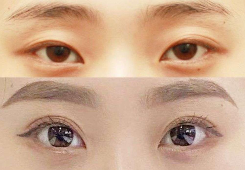 ���p��Ƥ��߀��ȫ����ȡ�Q�ڱ��˵��۲��l���͠�B(t��i)