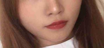 臉上的脂肪存活的很好