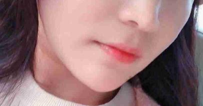 做了下颌角整形后脸型越来自然了