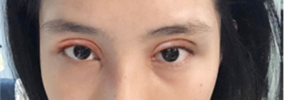 �p��Ƥ���g(sh��)׌�۾����������`���˺ܶ�