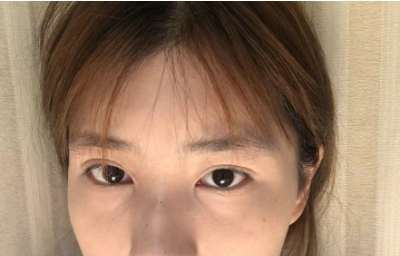 �p��Ƥ���g(sh��)׌�۾����������`���˺ܶ�