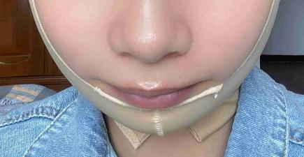 臉型越來(lái)自然了