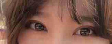 双眼皮特别自然有神,朋友都说我双眼皮做的很好