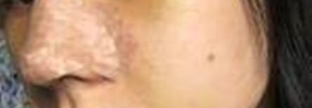 隆鼻真的可以讓人變得越來越好看