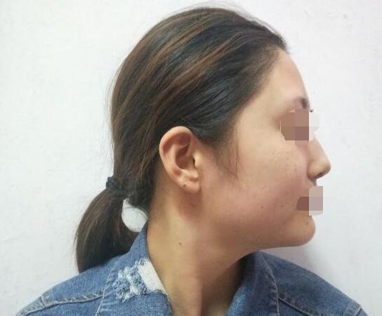 ���a������g(sh��)׌�ҵ��沿�ÿ�������