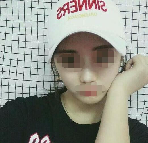 ���a������g(sh��)׌�ҵ��沿�ÿ�������