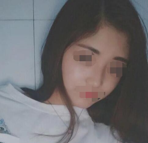 ���a������g(sh��)׌�ҵ��沿�ÿ�������