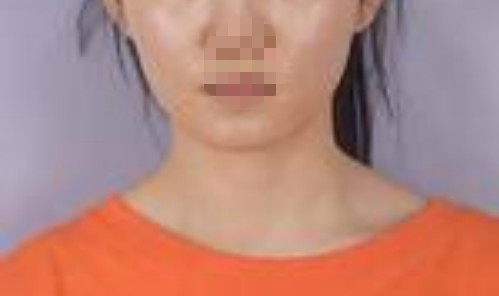 �����沿֮�������w��݆�����ÿ���