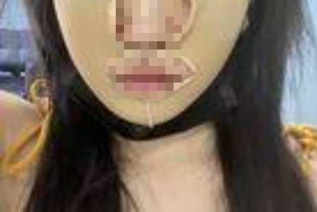 �����沿֮�������w��݆�����ÿ���