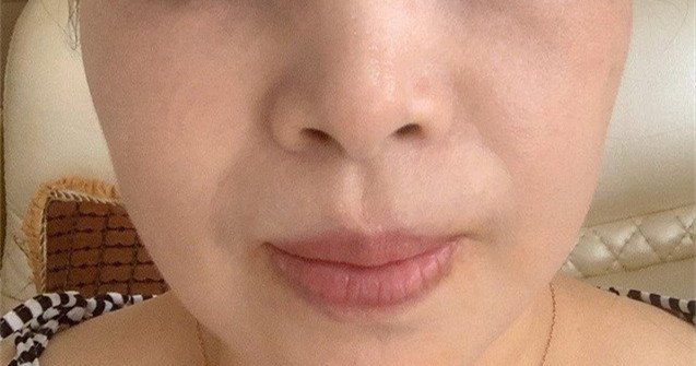 祛斑效果令人驚艷,臉上干凈美麗