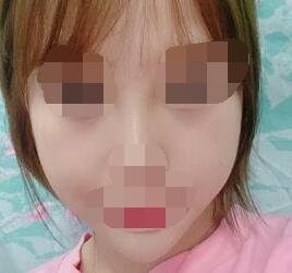 �����沿��֬���g׌��׃�ɾ��¹���Ę